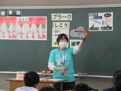 歯の磨き方の説明を受けている写真