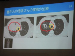 2024.12.11　6年生　ガン教育